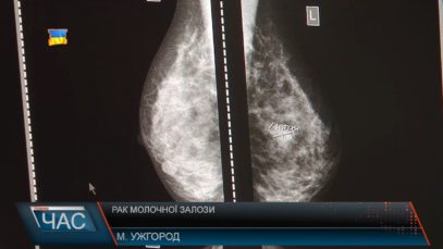 День боротьби з раком молочної залози