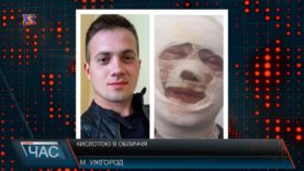 Хлюпнули в обличчя кислотою