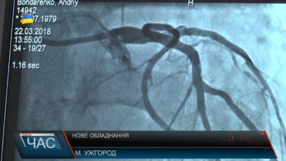 В обласному кардіодиспансері– нове обладнання
