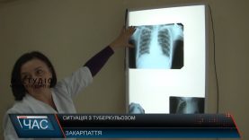 Выд туберкульозу за рік померли 150 закарпатців