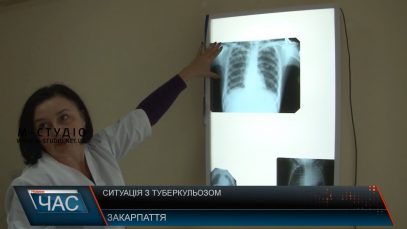 Выд туберкульозу за рік померли 150 закарпатців
