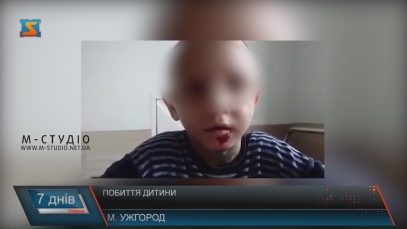 За катування дитини в ужгородській прийомній родині досі ніхто не відповів