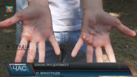 14-річний виноградівець бореться з хворобою, яка буває в одного зі ста тисяч
