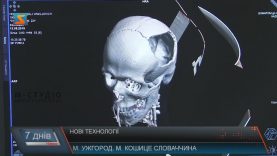 У медичному центрі «Діамед» встановлюватимуть індивідуально виготовлені імпланти