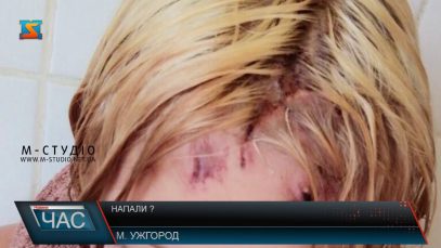 20-річна ужгородка каже, що на неї напав знайомий. Поліція заперечує