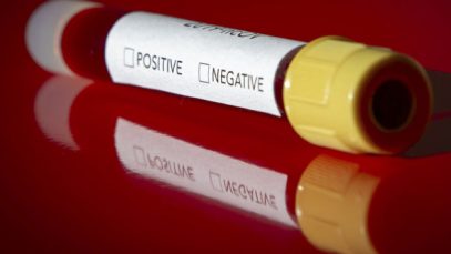 ANKARA, TURKEY – FEBRUARY 14: In this photo illustration a coron