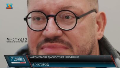 Акромегалія: діагностика і лікування