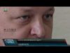 Ящур і блутанг: відкрита гаряча лінія